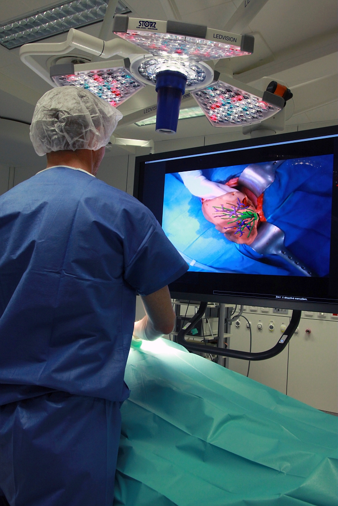 Aide à la chirurgie (opération du foie)